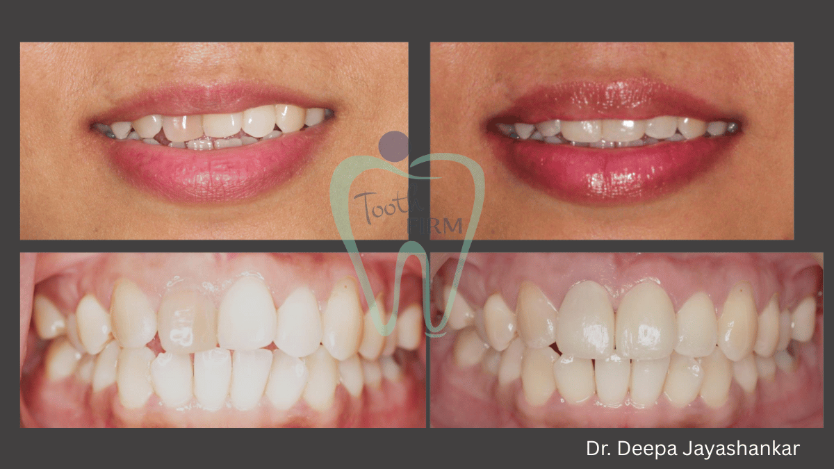 Smile Designing  loading=