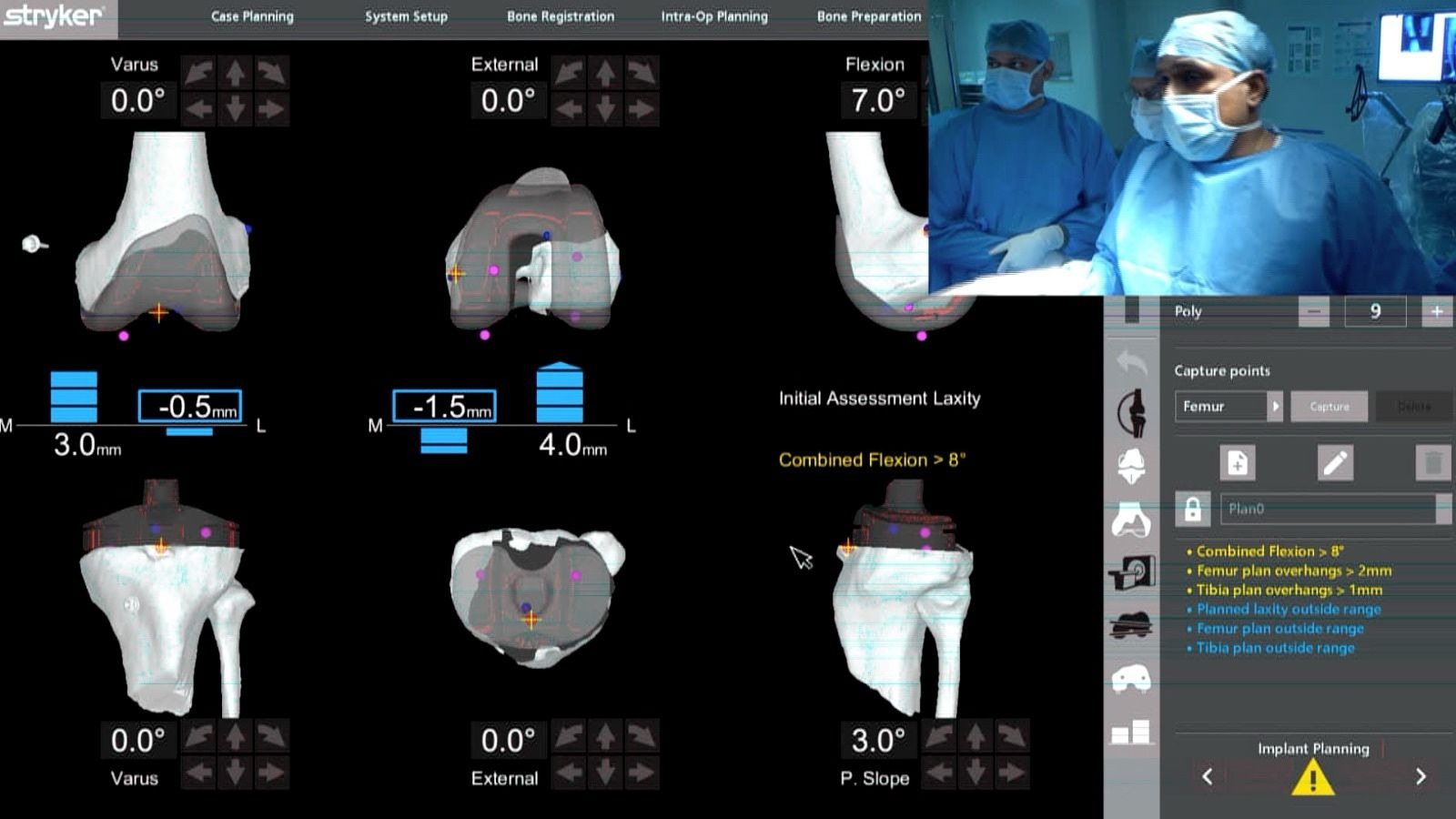 SPARSH ARTHROPLASTY COURSE 2024 loading=