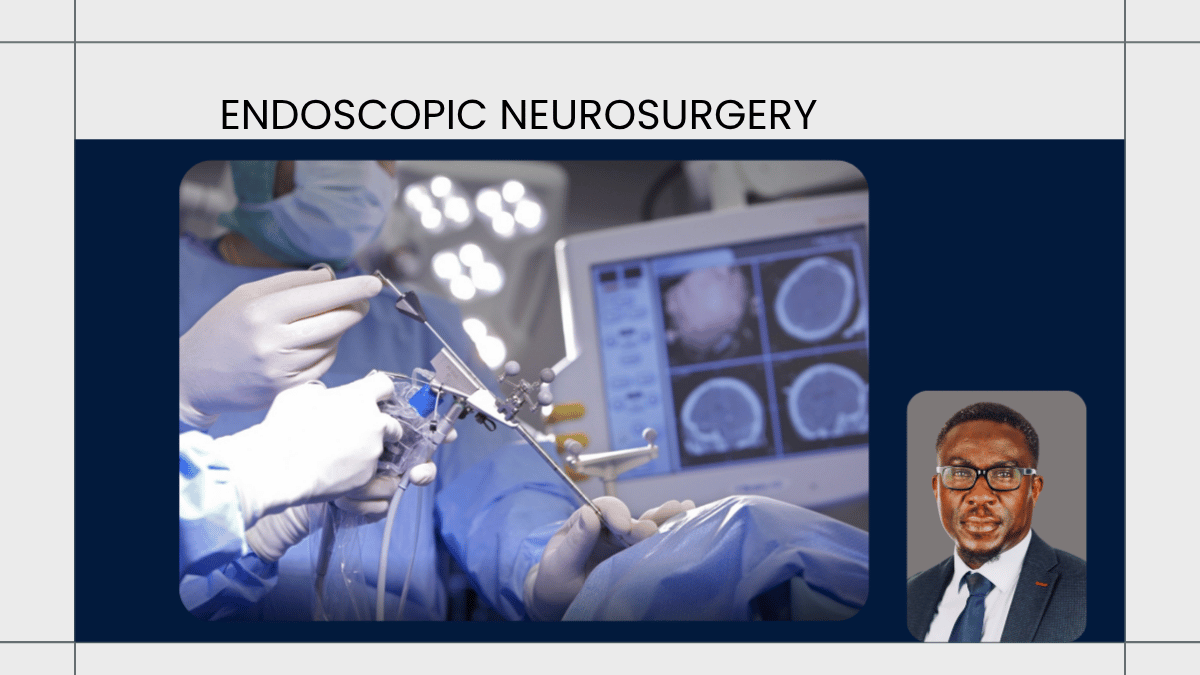 Endoscopic Neurosurgery
