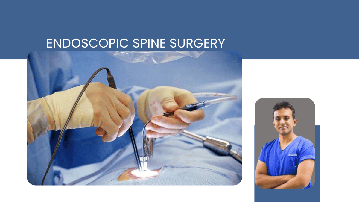 Endoscopic Spine Surgery