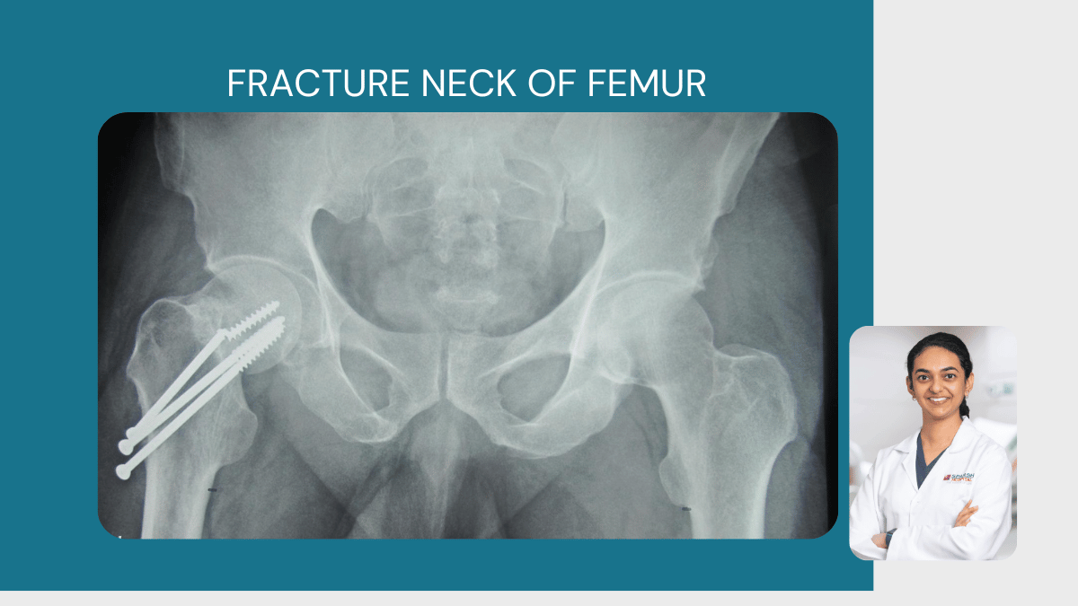 Fracture Neck of Femur 