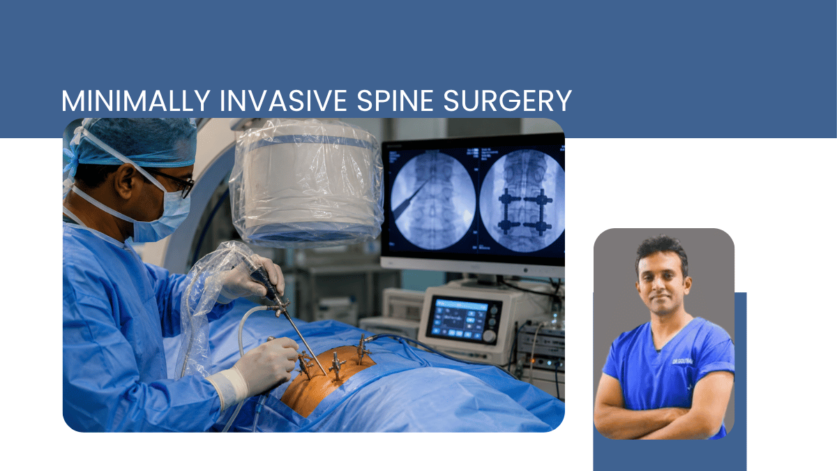 Minimally Invasive Spine Surgery