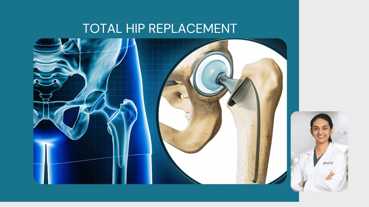 Total Hip Replacement 