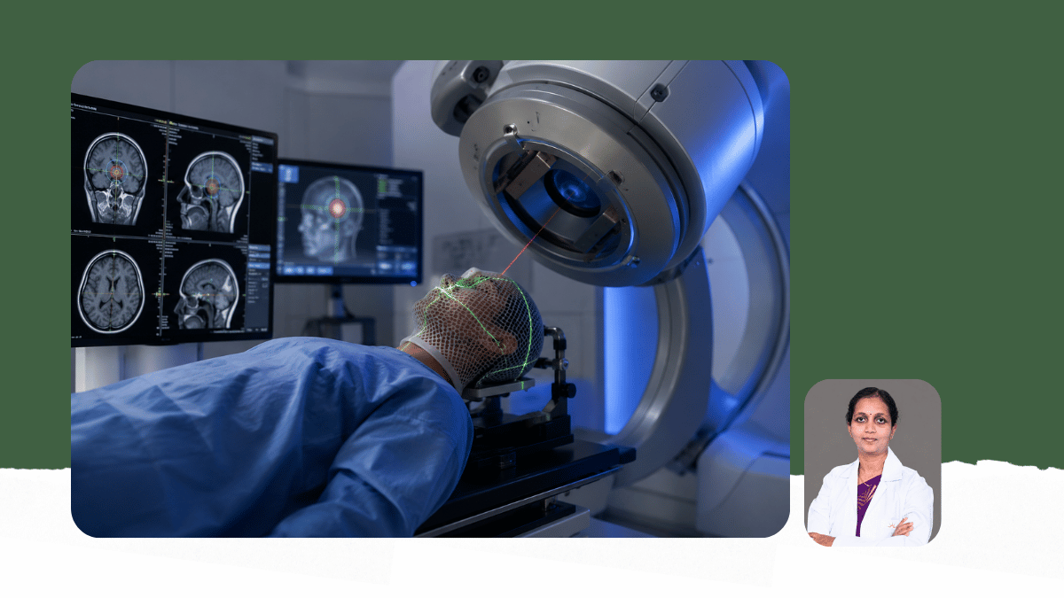 Brain Tumours - Stereotactic Radiosurgery (SRS)