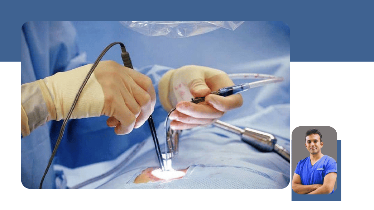 Endoscopic Spine Surgery