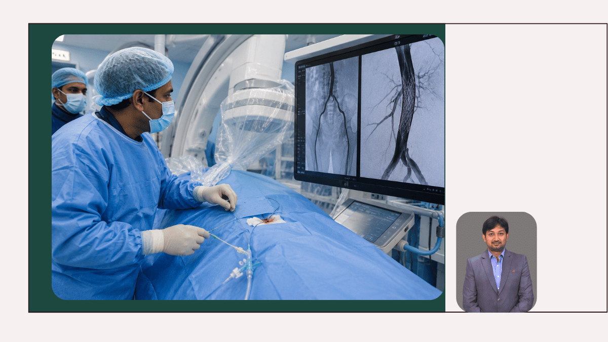 Endovascular Surgery