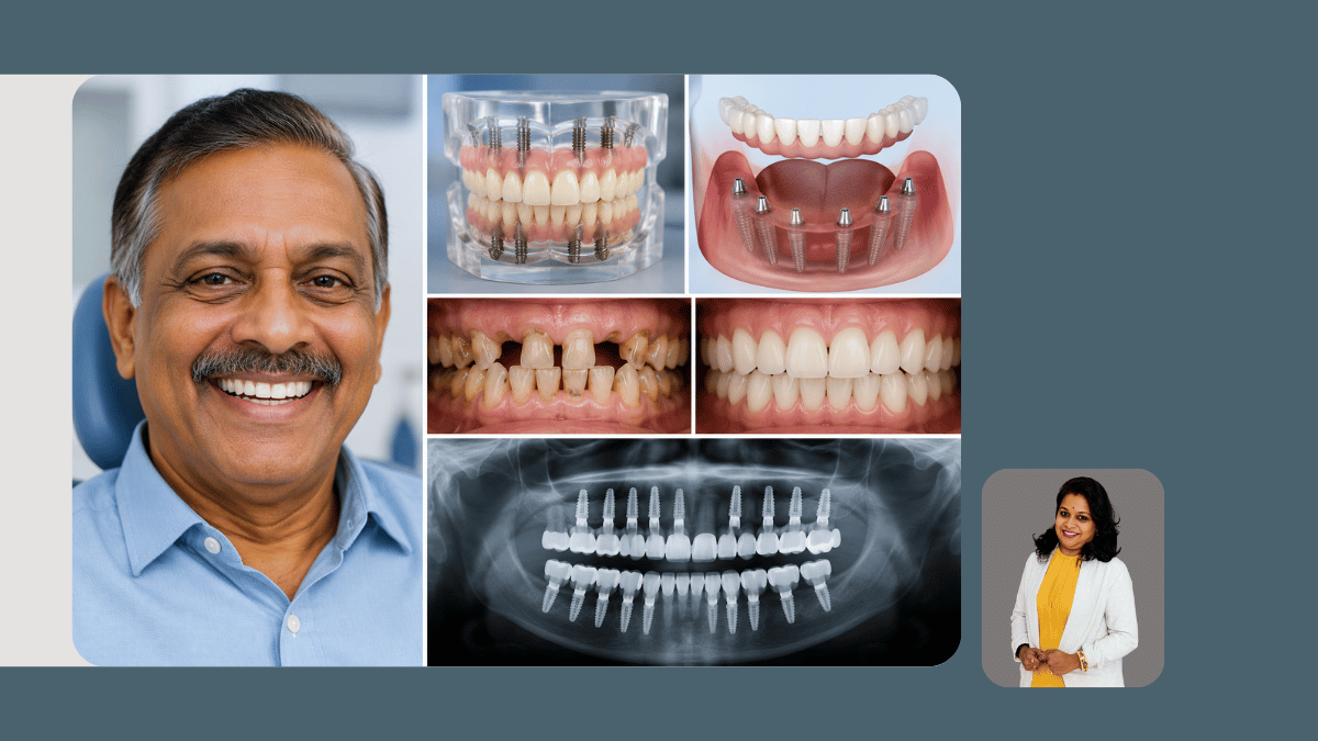  Full-Mouth Rehabilitation