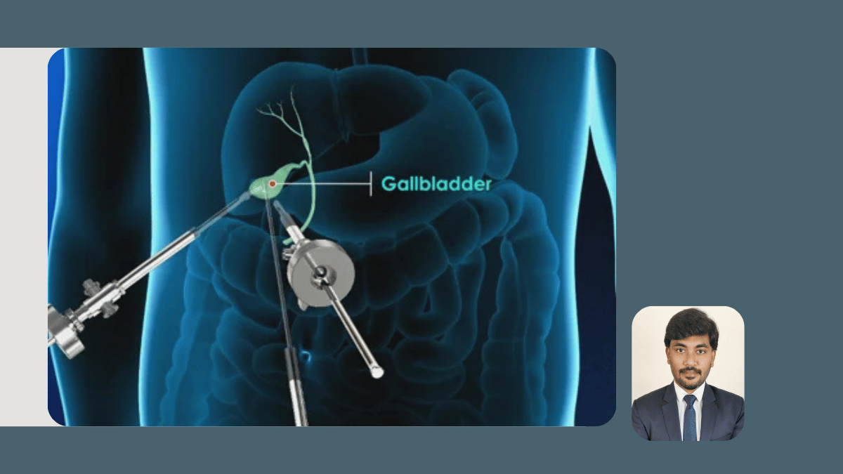 Hernia, Gallbladder and Appendix Surgery 