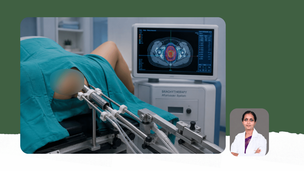 Internal Radiation - Brachytherapy