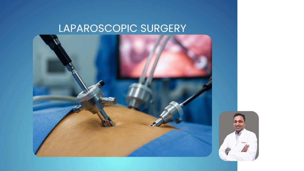 Laparoscopic Surgery