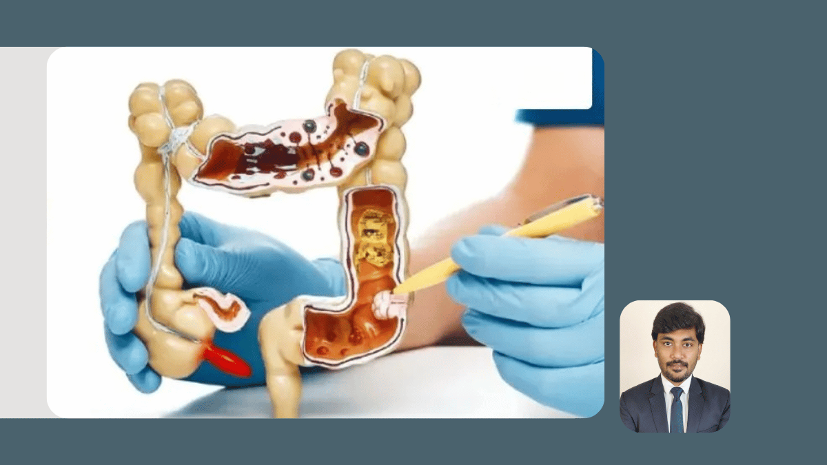  Laser and Proctology Procedures