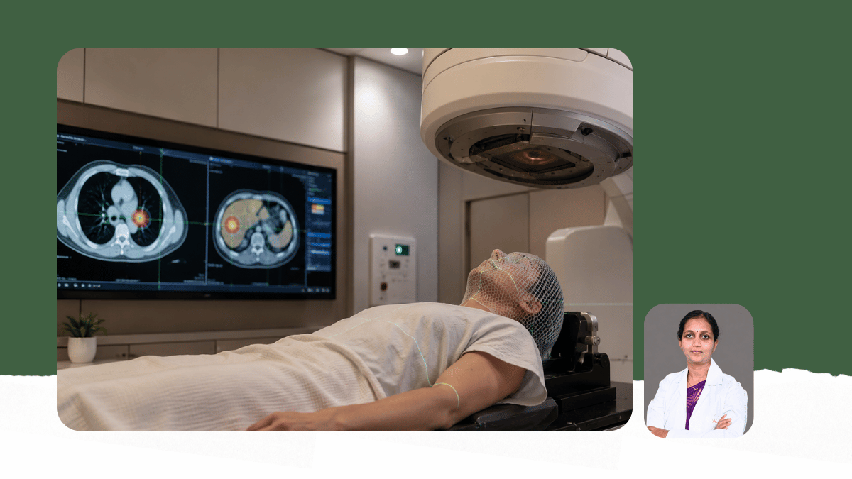 Lung and Liver Tumours - Stereotactic Body Radiotherapy (SBRT)