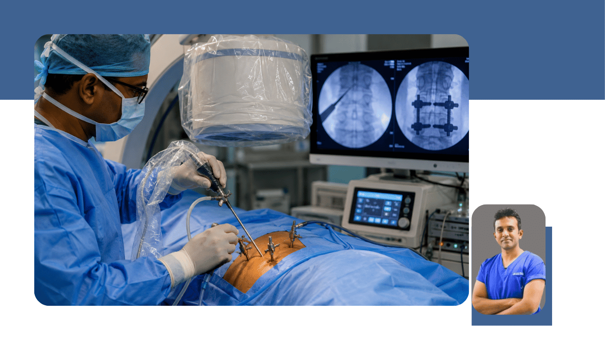 Minimally Invasive Spine Surgery