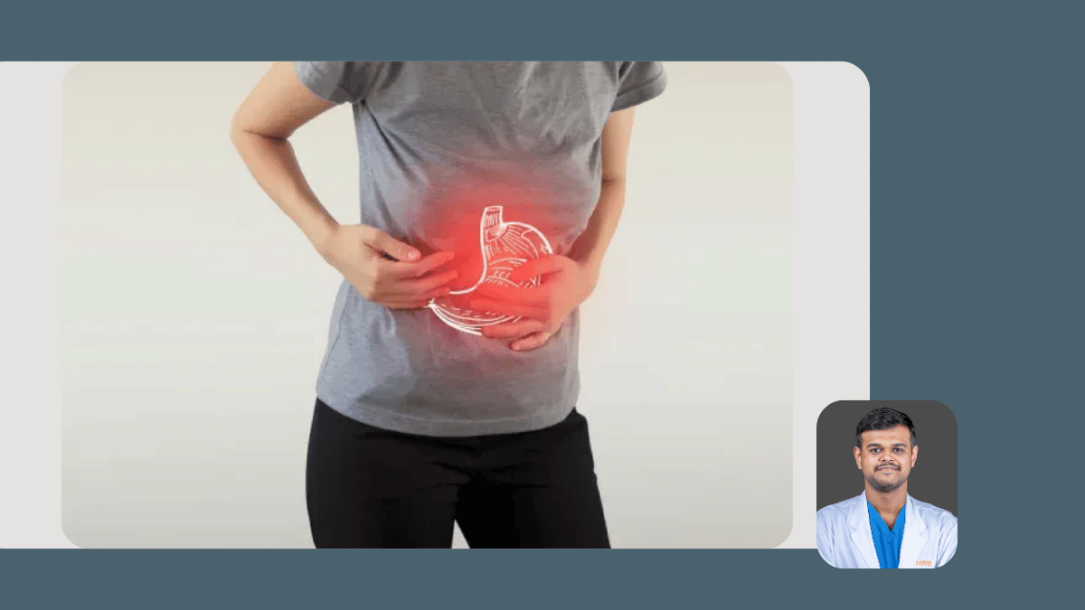 Benign Gastrointestinal and HPB Disorders