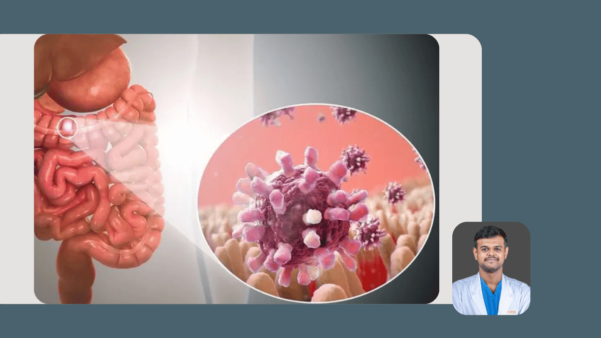 Gastrointestinal and HPB Cancers
