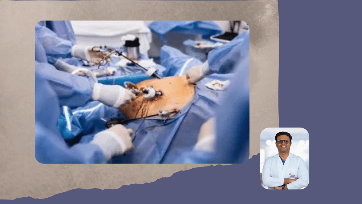 Laparoscopic Hernia Repair
