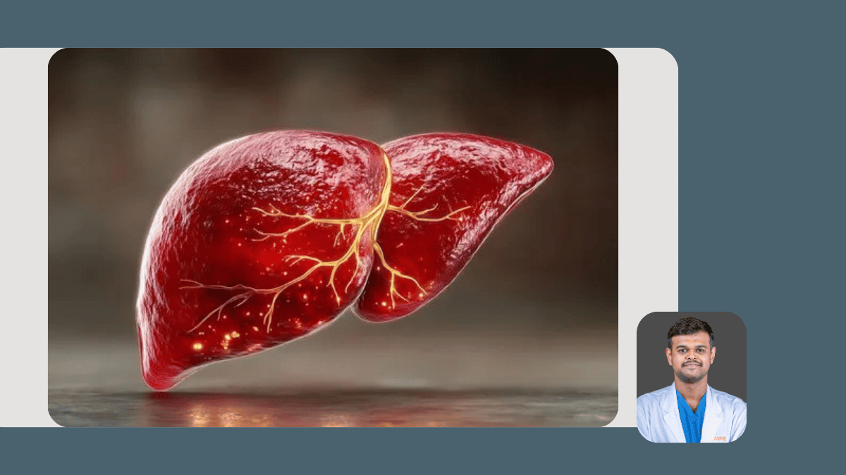 Liver Diseases and Liver Transplantation
