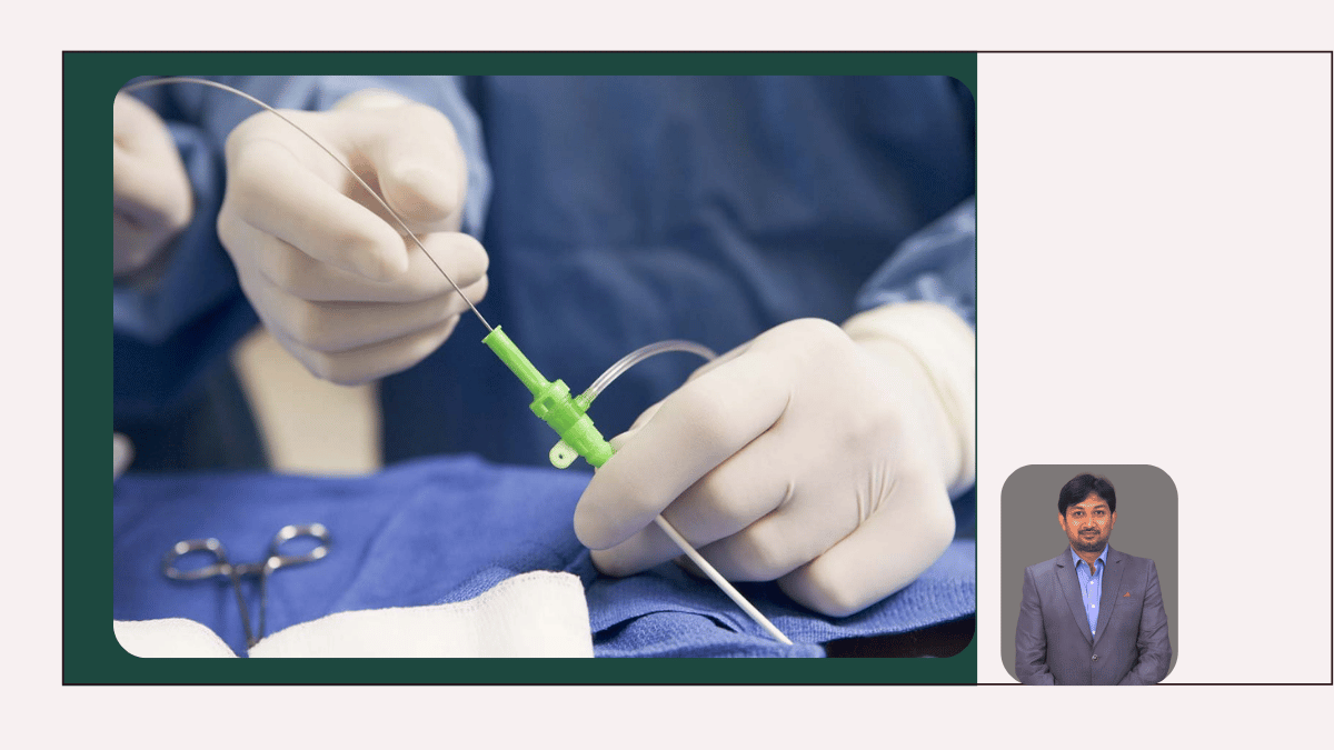 Endovascular Surgery and Vascular Interventions: Treating Vascular Disease from the Inside