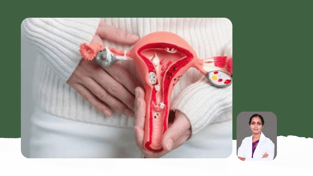 Internal Radiation: Brachytherapy for Cervical and Gynaecological Cancers