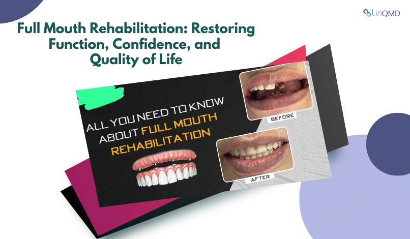 Full Mouth Rehabilitation: Restoring Function, Confidence, and Quality of Life – A Clinician’s Perspective