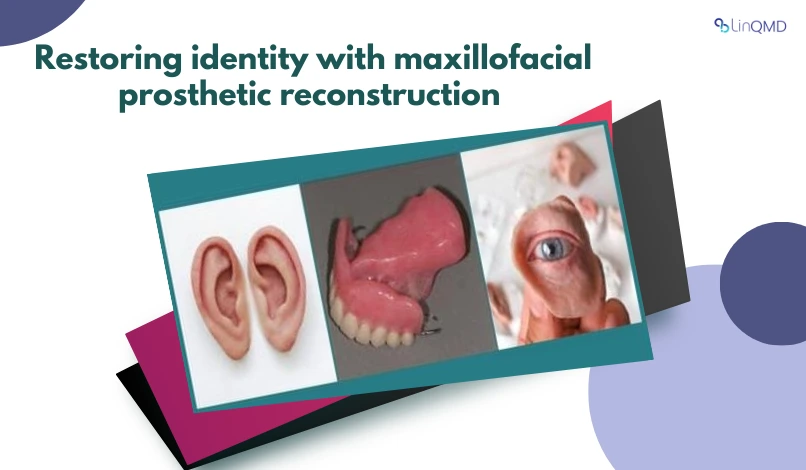 Restoring Identity Through Maxillofacial Prosthetic Reconstruction: A Specialist’s Perspective  By Dr. Supriya Manvi, Prosthodontist & Maxillofacial Rehabilitation Specialist