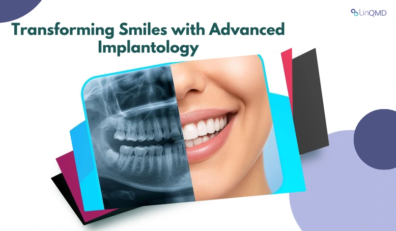 Transforming Smiles with Advanced Implantology: A Specialist’s Perspective By Dr. Supriya Manvi, Prosthodontist & Implantologist	