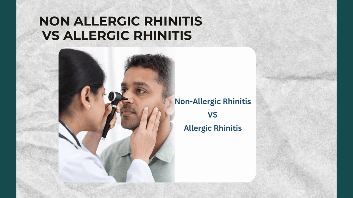 Non Allergic Rhinitis VS Allergic Rhinitis