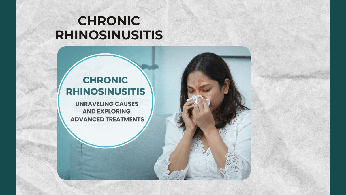 Chronic Rhinosinusitis: Unraveling Causes and Exploring Advanced Treatments