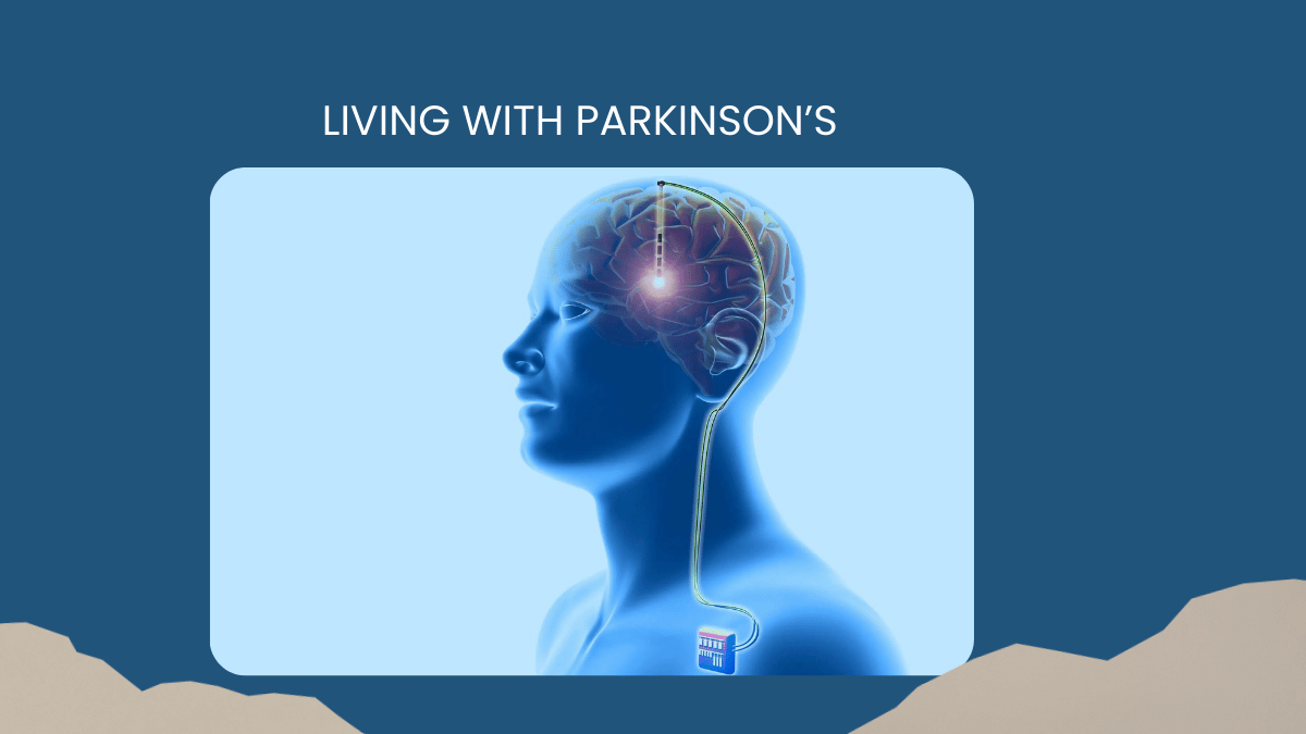 Living with Parkinson’s When Is It Time to Consider Surgery