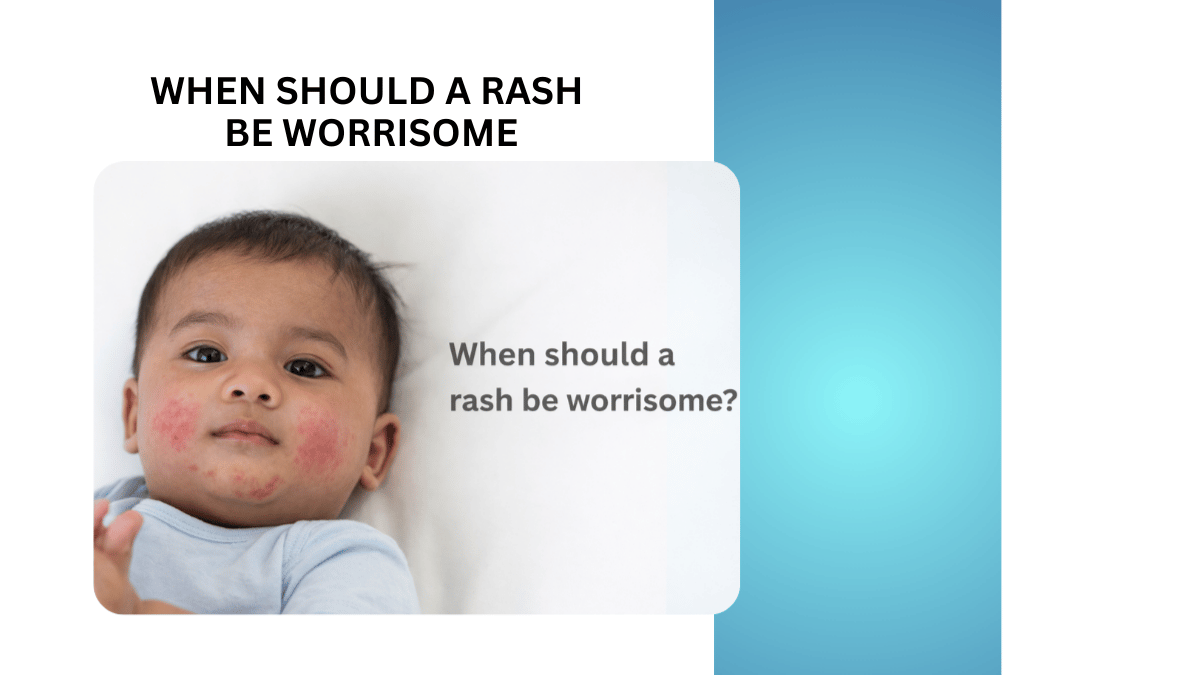 When Should a Rash Be Worrisome