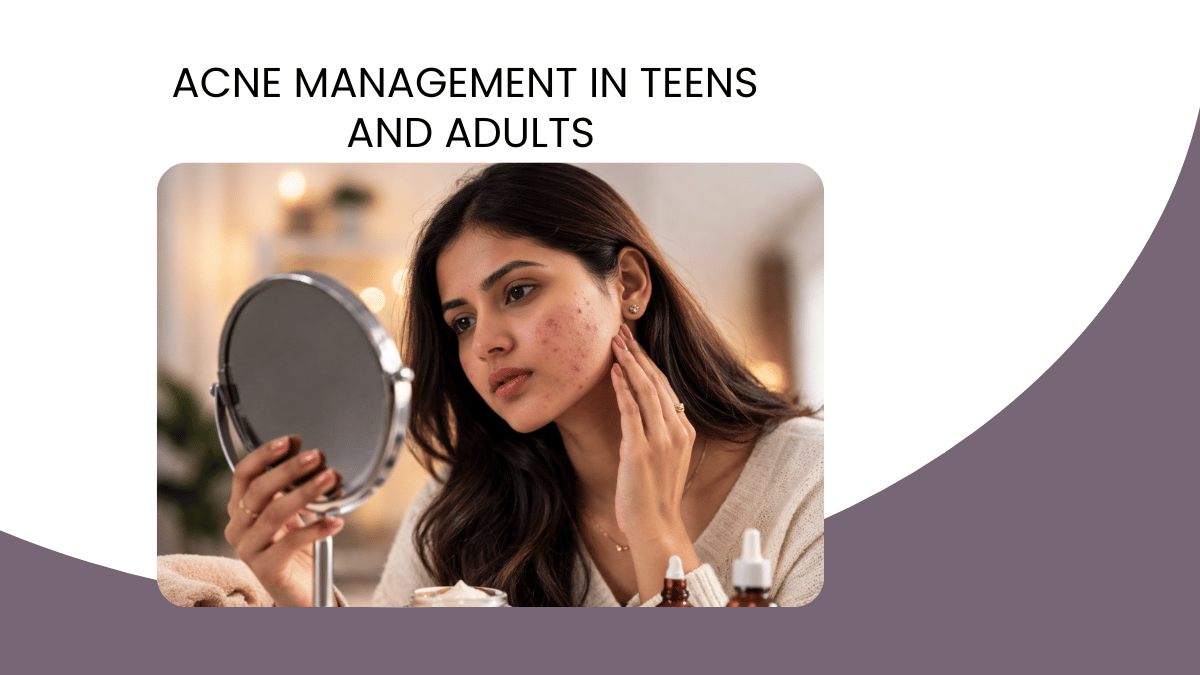 Acne Management in Teens and Adults