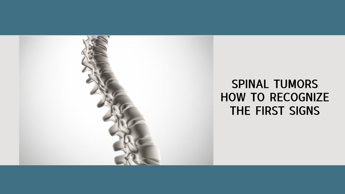 Spinal Tumors How to Recognize the First Signs