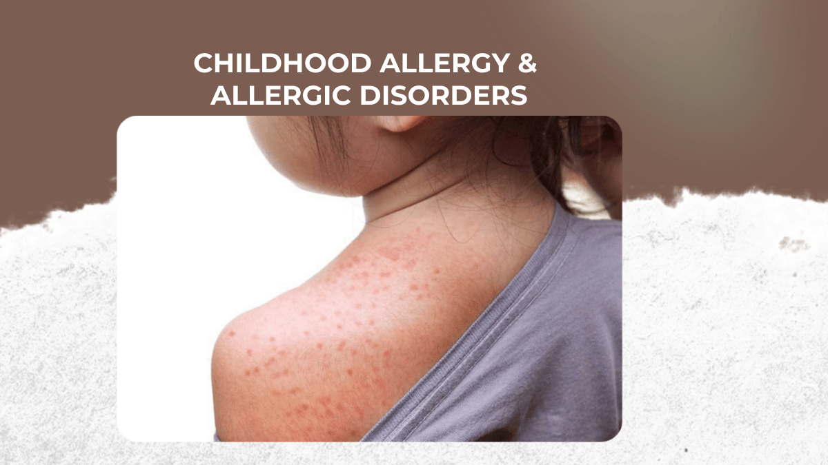 Childhood Allergy & Allergic Disorders