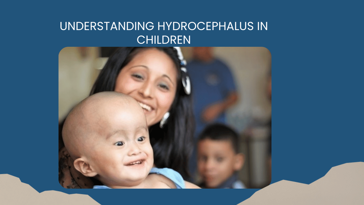 Understanding Hydrocephalus in Children: Causes, Symptoms, and Treatment