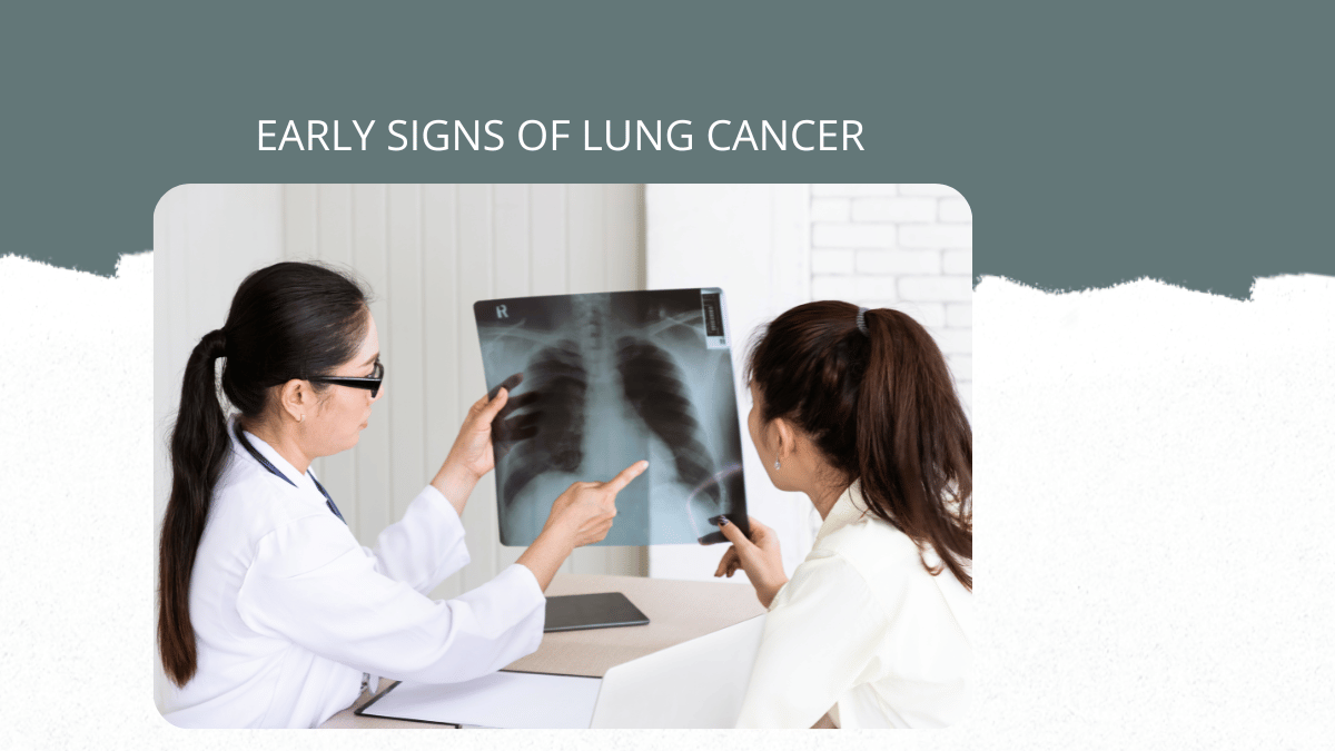 Early Signs of Lung Cancer: When Should You See an Oncologist?