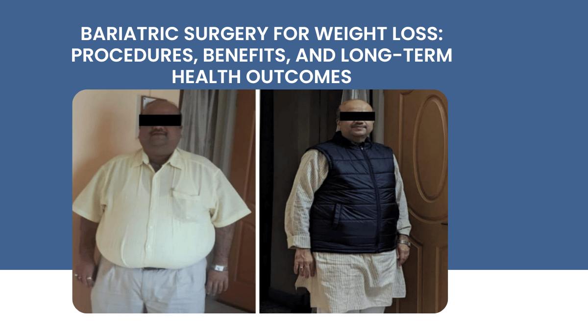Bariatric Surgery for Weight Loss: Procedures, Benefits, and Long-Term Health Outcomes