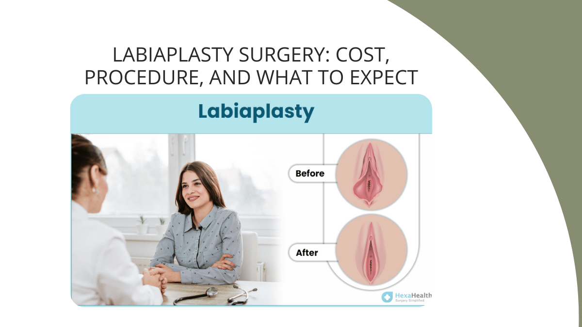 Labiaplasty Surgery: Cost, Procedure, and What to Expect