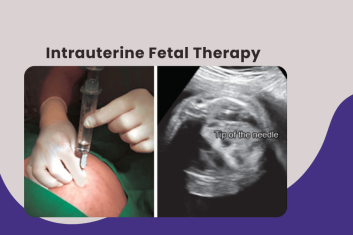 https://d2vvc091k8tmib.cloudfront.net/s3fs-public/2026-05/Intrauterine%20Fetal%20Therapy.png