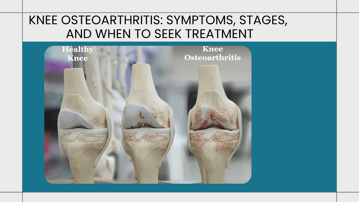 knee osteoarthritis symptoms stages treatment bengaluru