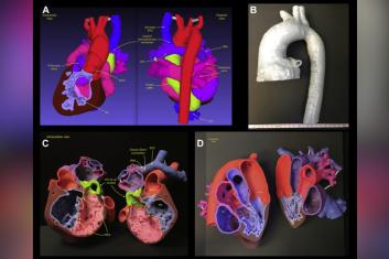 https://d2vvc091k8tmib.cloudfront.net/s3fs-public/2026-05/Pediatric%20Cardiology.jpg