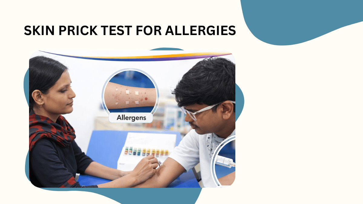 Skin Prick Test for Allergies: What to Expect and How It Helps Diagnosis 
