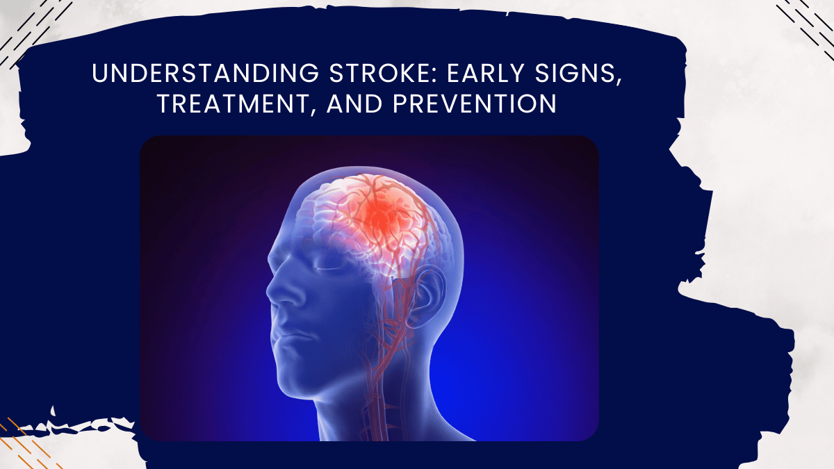 understanding stroke early signs treatment and prevention