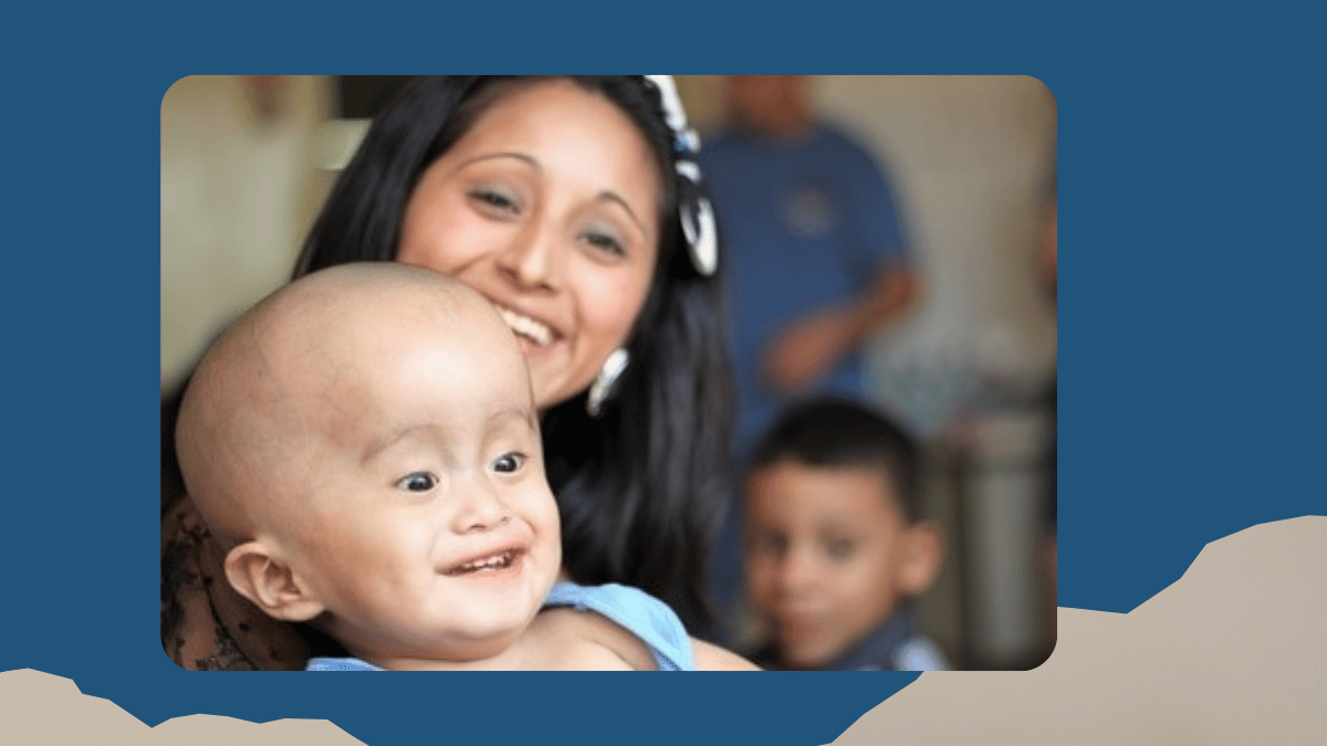 https://d2vvc091k8tmib.cloudfront.net/s3fs-public/2026-07/Understanding%20Hydrocephalus%20in%20Children.png