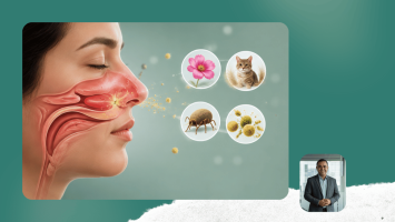 Allergic Rhinitis & Nasal Allergy