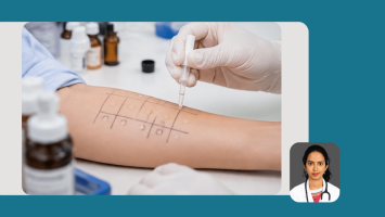  Allergic Rhinitis and Allergy Management