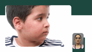 Allergy Care in Children