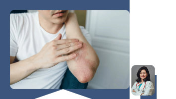 Allergy Diagnosis and Treatment