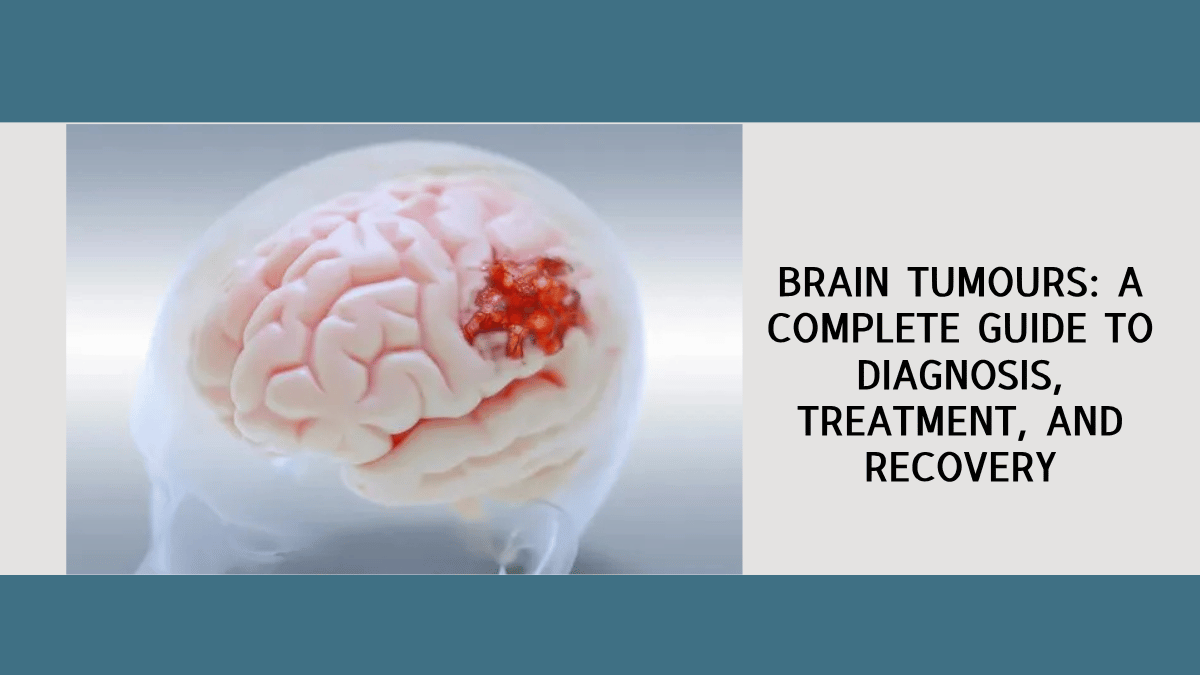 brain tumours complete guide neurosurgeon bidar