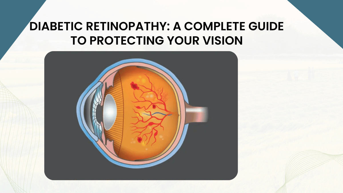 https://d2vvc091k8tmib.cloudfront.net/s3fs-public/2026-08/Diabetic%20Retinopathy%20A%20Complete%20Guide%20to%20Protecting%20Your%20Vision.png