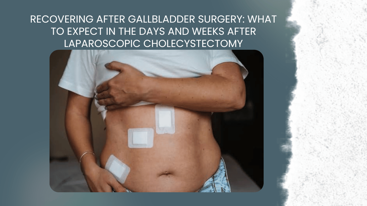 recovering after gallbladder surgery laparoscopic cholecystectomy jayanagar